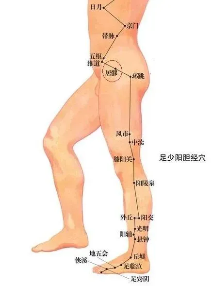 腰间盘突出怎么治疗最好的方法,腰间盘突出怎么治效果最好最快