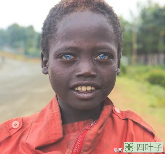 蓝眼睛在非洲确实存在，但不常见，非常有趣
