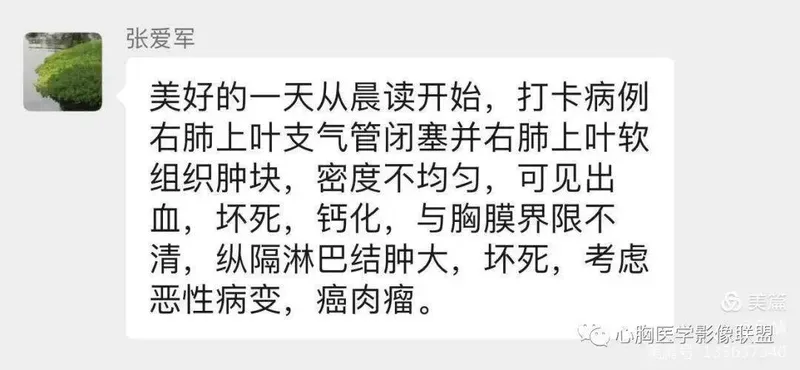 她强任他强清风拂山岗什么意思 女生说他强任他强清风拂山岗 女生写他强任他强清风拂山岗