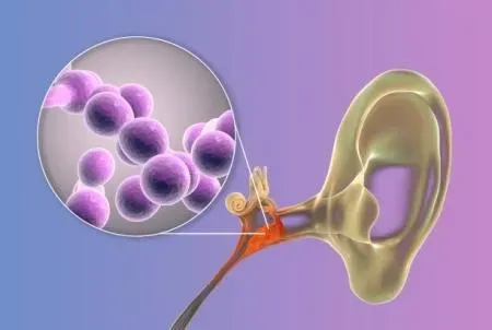 感染耳念珠菌多少天发病 感染耳念珠菌用什么药？