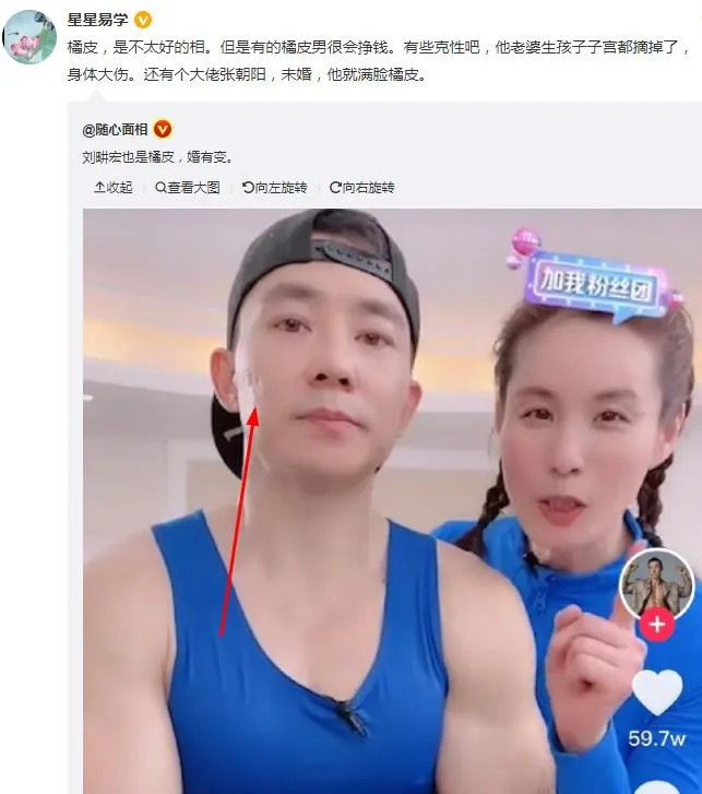 橘皮男什么意思 橘皮男真的都不好吗 橘皮男面相图片