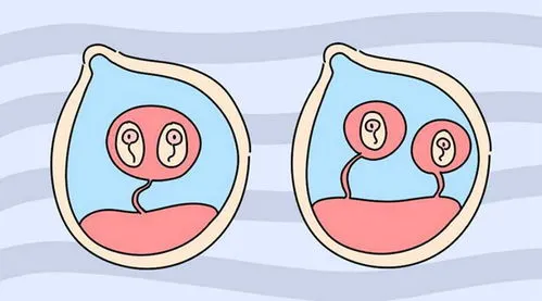 三代试管可以选择婴儿性别吗,【生育揭秘】想生龙凤胎、生双胞胎？试管婴儿可以选择性别吗？