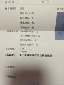 新冠三个月了还是阳性