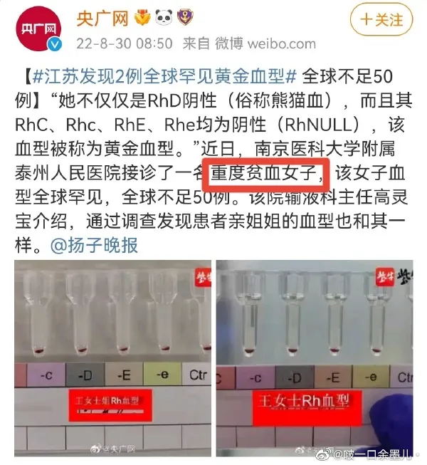 江苏发现2例全球罕见黄金血型 江苏发现最罕见血型